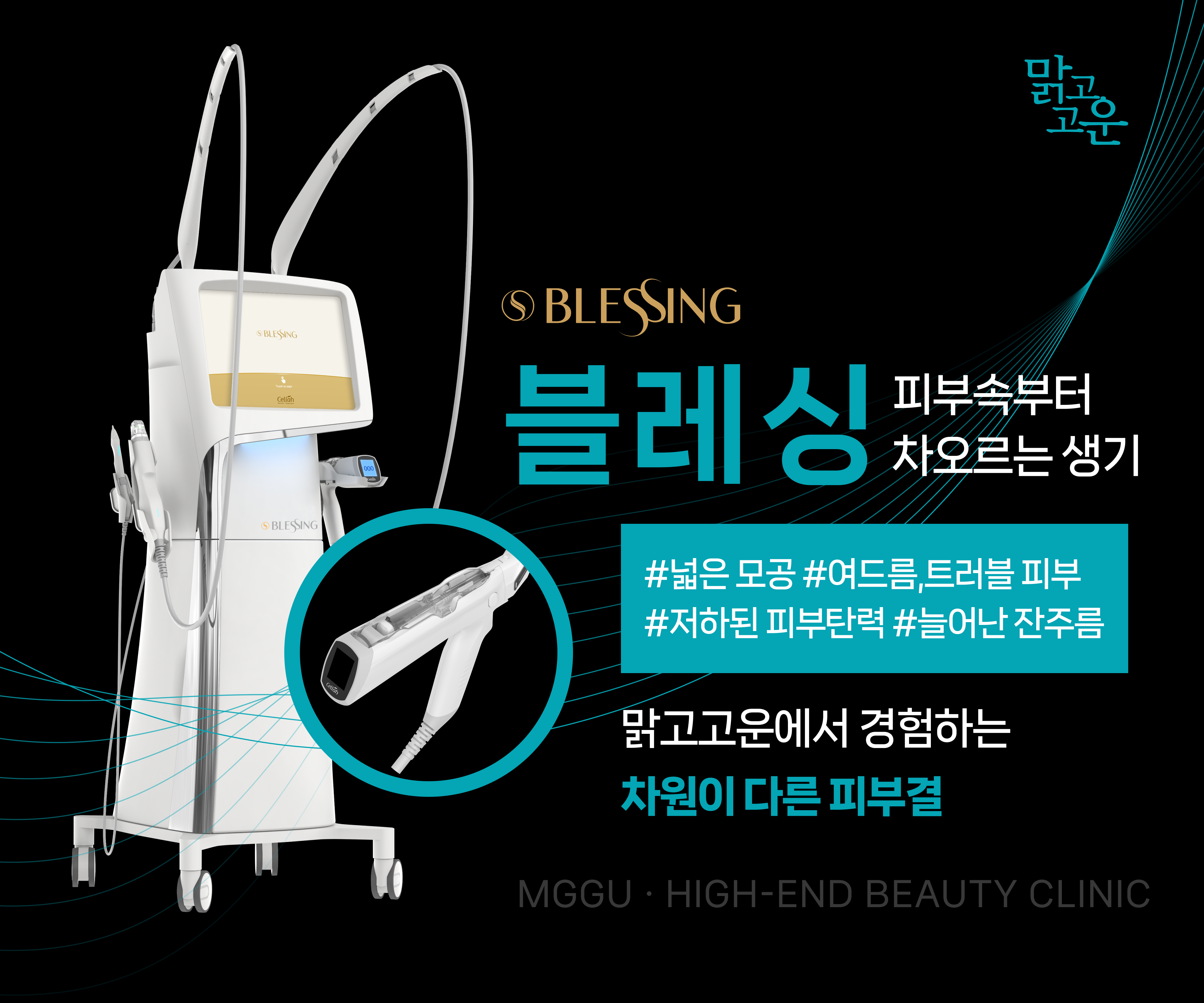 맑고고운에서 "블레싱" 시술을 새롭게 선보입니다.
